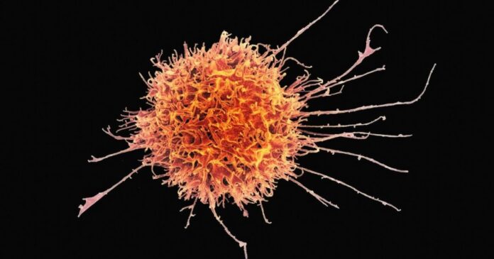 national-institute-of-allergy-and-infectious-diseases-4QL1cV7N7b4-unsplash-e1729493672789.jpg