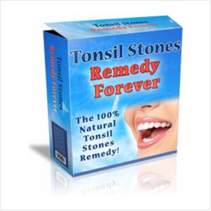 Cure Tonsil Stones Naturally