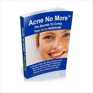 Can You Cure Acne Naturally?