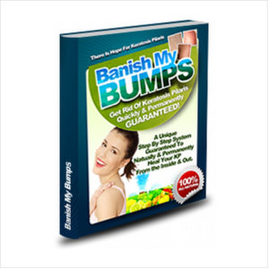 Banish my bumps