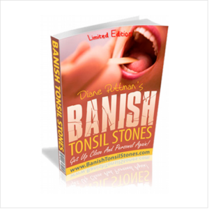 Banish tonsil stones VSL